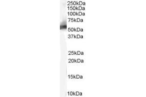 Image no. 1 for anti-Mdm2, p53 E3 Ubiquitin Protein Ligase Homolog (Mouse) (MDM2) (Internal Region) antibody (ABIN374627) (MDM2 anticorps  (Internal Region))