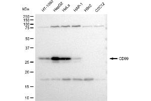 Western blotting analysis using CD99 antibody (ABIN7797990).