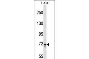 GALNT6 Antibody (C-term) (ABIN1537465 and ABIN2848506) western blot analysis in Hela cell line lysates (35 μg/lane). (GALNT6 anticorps  (C-Term))