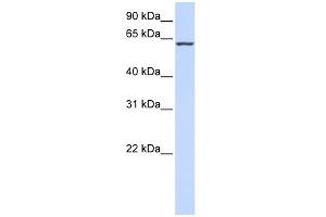 WB Suggested Anti-PROC Antibody Titration:  0. (PROC anticorps  (Middle Region))