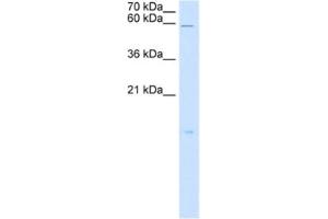 Western Blotting (WB) image for anti-Retinoic Acid Receptor Responder (Tazarotene Induced) 3 (RARRES3) antibody (ABIN2462984) (RARRES3 anticorps)