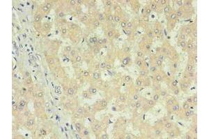 Immunohistochemistry of paraffin-embedded human liver using  in 30 μg/mL dilute concentrations.
