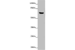Western blot All lanes: CERKL antibody at 14 μg/mL + Mouse lung tissue Secondary Goat polyclonal to rabbit IgG at 1/10000 dilution Predicted band size: 63, 60, 53, 48, 43, 25, 20, 58 kDa Observed band size: 63 kDa (CERKL anticorps  (AA 1-558))