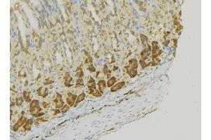 ABIN6273356 at 1/100 staining Human gastric tissue by IHC-P. (MCF2L anticorps  (Internal Region))