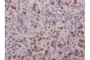 anti-S100 Calcium Binding Protein A4 (S100A4) (AA 2-101) antibody