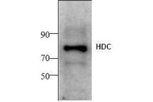 Image no. 1 for anti-Histidine Decarboxylase (HDC) antibody (ABIN155152) (HDC anticorps)