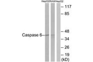Western blot analysis of extracts from HepG2/RAW264. (Caspase 6 anticorps  (AA 223-272))