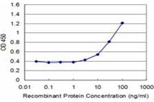 anti-Zinc Finger Protein 79 (ZNF79) (AA 52-151) antibody