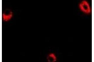 Immunofluorescent analysis of ADSS staining in Hela cells.