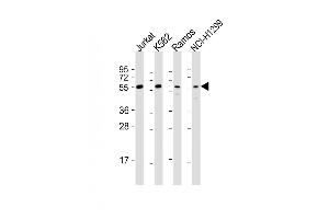 All lanes : Anti-FOXO4 Antibody (Center) at 1:1000-1:2000 dilution Lane 1: Jurkat whole cell lysates Lane 2: K562 whole cell lysates Lane 3: Ramos whole cell lysates Lane 4: NCI- whole cell lysates Lysates/proteins at 20 μg per lane. (FOXO4 anticorps  (AA 206-240))