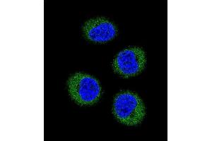 Confocal immunofluorescent analysis of FGR Antibody (N-term) (ABIN392096 and ABIN2841848) with MDA-M cell followed by Alexa Fluor 488-conjugated goat anti-rabbit lgG (green).