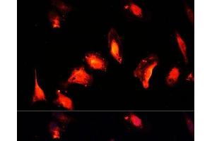 Immunofluorescence analysis of U-2 OS cells using MYST1 Polyclonal Antibody at dilution of 1:100 (40x lens). (MYST1 anticorps)
