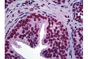 Anti-LHX4 antibody IHC of human prostate. (LHX4 anticorps  (AA 291-390))