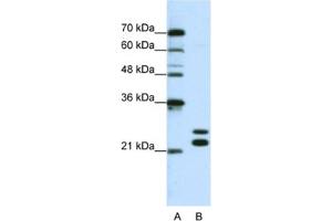 Western Blotting (WB) image for anti-Cold Shock Domain Containing C2, RNA Binding (CSDC2) antibody (ABIN2462255) (CSDC2 anticorps)