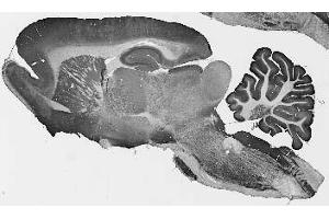 Adult rat brain immunohistochemistry. (CLCN3 anticorps  (Cytosolic, N-Term))