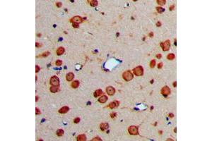 Immunohistochemical analysis of Fibulin 4 staining in human brain formalin fixed paraffin embedded tissue section.