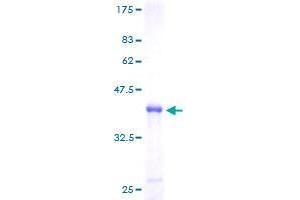 Image no. 1 for Zinc Finger Protein 593 (ZNF593) (AA 1-116) protein (GST tag) (ABIN1326317)