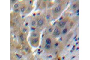 Used in DAB staining on fromalin fixed paraffin-embedded Liver tissue