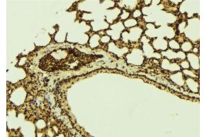 ABIN6273203 at 1/100 staining Mouse lung tissue by IHC-P. (C14orf166 anticorps)