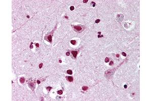 Anti-FMNL2 antibody IHC of human brain, cortex. (FMNL2 anticorps  (AA 1-50))