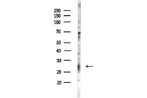 Western blot analysis of lysates from COLO205 cells(UV,30 min treatment), using Syntaxin 17 Antibody at 1/1000 dilution.