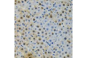 Immunohistochemistry of paraffin-embedded rat liver using BUB1 Antibody.