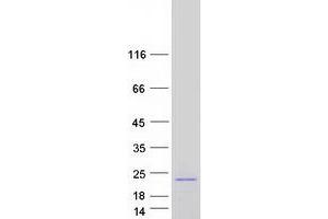 Validation with Western Blot