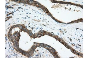 Image no. 6 for anti-Transforming, Acidic Coiled-Coil Containing Protein 3 (TACC3) antibody (ABIN1498098) (TACC3 anticorps)