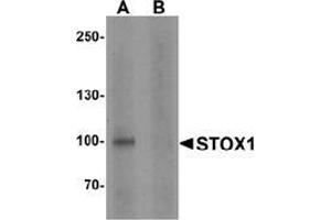 Western blot analysis of STOX1 in human liver tissue lysate with STOX1 antibody at 1 ug/ml in (A) the absence and (B) the presence of blocking peptide. (STOX1 anticorps  (C-Term))