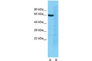 Host:  Rabbit  Target Name:  DDX41  Sample Type:  Jurkat  Lane A:  Primary Antibody  Lane B:  Primary Antibody + Blocking Peptide  Primary Antibody Concentration:  1ug/ml  Peptide Concentration:  5. (DDX41 anticorps  (N-Term))