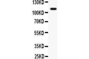 Anti- C-Kit Picoband antibody, Western blotting All lanes: Anti C-Kit  at 0. (KIT anticorps  (AA 26-285))
