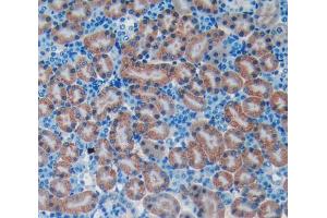 Used in DAB staining on fromalin fixed paraffin- embedded kidney tissue (BNP anticorps  (AA 27-121))