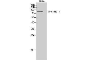 Western Blotting (WB) image for anti-DNA Polymerase I (C-Term) antibody (ABIN3174788) (DNA Polymerase I (C-Term) anticorps)