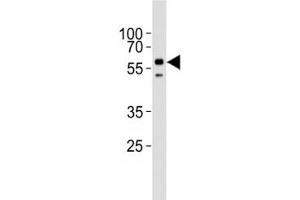 Western blot analysis of lysate from HepG2 cell line using ALK2 antibody