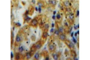 IHC-P analysis of Kidney tissue, with DAB staining. (Tissue factor anticorps  (AA 30-251))