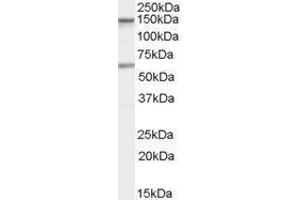 Western Blotting (WB) image for Caspase Recruitment Domain Family, Member 11 (CARD11) peptide (ABIN369694) (Caspase Recruitment Domain Family, Member 11 (CARD11) Peptide)