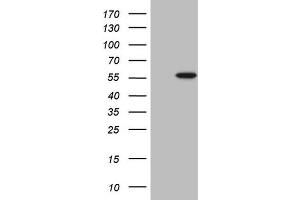 Western Blotting (WB) image for anti-4-Aminobutyrate Aminotransferase (ABAT) (AA 29-323) antibody (ABIN2715595)