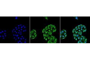 Immunocytochemistry/Immunofluorescence analysis using Mouse Anti-HSP70 Monoclonal Antibody, Clone 5A5 (ABIN361735 and ABIN361736). (HSP70 anticorps)