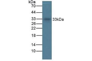 Mouse Detection antibody from the kit in WB with Positive Control: Sample Human Liver lysate.