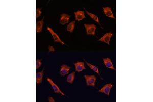 Immunofluorescence analysis of L929 cells using M antibody (ABIN3023031, ABIN3023032, ABIN3023033, ABIN1513170 and ABIN6219356) at dilution of 1:100.