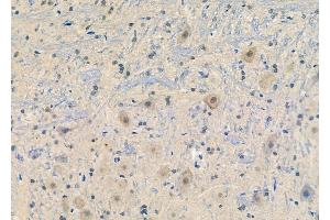 Phospho-Synapsin I (Ser62/Ser67) Antibody at 1/100 staining Rat brain tissue by IHC-P. (SYN1 anticorps  (pSer62, pSer67))