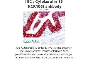 Image no. 1 for anti-Keratin 19 (KRT19) antibody (ABIN1724421) (Cytokeratin 19 anticorps)