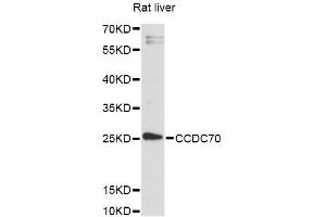 Western blot analysis of extracts of rat liver, using CCDC70 antibody (ABIN6292810) at 1:3000 dilution. (CCDC70 anticorps)