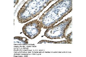 Human Intestine (GABRP anticorps  (N-Term))
