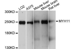 Western blot analysis of extracts of various cell lines, using MYH11 antibody.