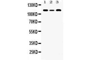 Western blot analysis of HLTF expression in rat cardiac muscle extract ( Lane 1), mouse spleen extract ( Lane 2) and human placenta extract ( Lane 3). (HLTF anticorps  (AA 911-1009))