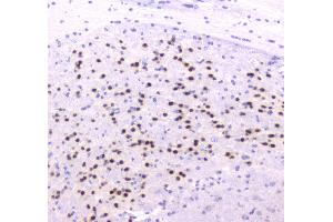 IHC analysis of ESRRG using anti-ESRRG antibody .