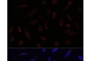 Immunofluorescence analysis of U-2 OS cells using ACAT1 Polyclonal Antibody at dilution of 1:100.