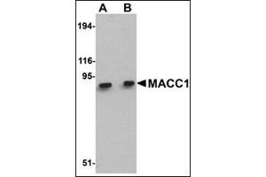 Western blot analysis of MACC1 in mouse liver tissue lysate with this product at (A) 1 and (B) 2 μg/ml. (MACC1 anticorps  (Center))