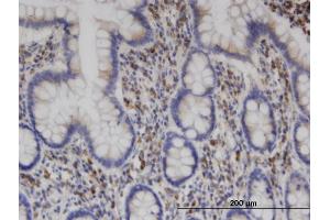 Immunoperoxidase of monoclonal antibody to CLINT1 on formalin-fixed paraffin-embedded human small Intestine.